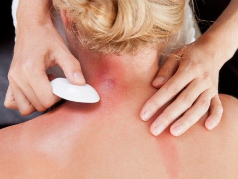 TCM Manual Therapy Overview